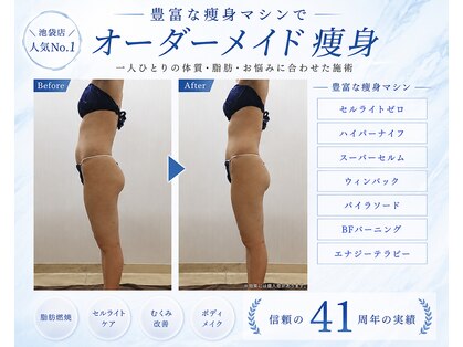 エステティック レイビス 池袋店(RAYVIS)の写真