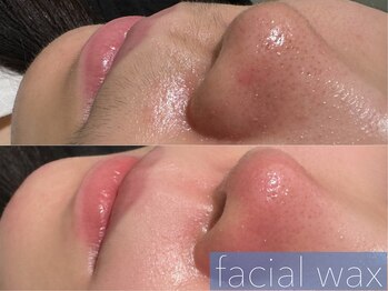 レーヴ(REVE)/フェイシャルWAX(鼻・口周り)