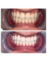 ライトビューティー 池袋店(LightBeauty)/症例写真