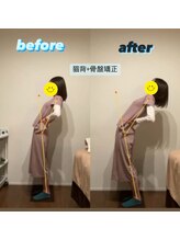 ラクリエ 姫路駅前院(La Creer)/後屈ビフォーアフター/骨盤/姿勢