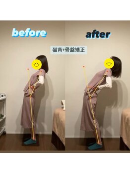 ラクリエ 姫路駅前院(La Creer)/後屈ビフォーアフター/骨盤/姿勢