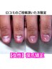 【深爪矯正口コミのご投稿を頂いた女性限定】¥24,200→¥23100