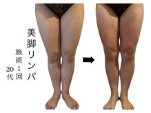 ラリマ(La-lima)/20代/美脚になりたい