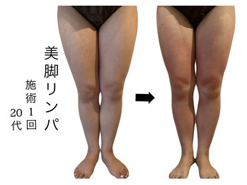 ラリマ(La-lima)/20代/美脚になりたい