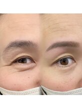 チルアンドアイ 千葉駅前店(Chill&Eye)/美眉スタイリング/BeforeAfter