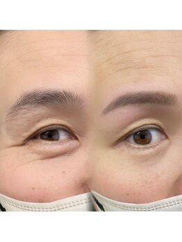 チルアンドアイ 千葉駅前店(Chill&Eye)/美眉スタイリング/BeforeAfter