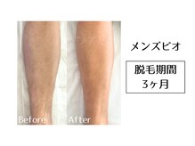 メンズビオ 神戸三宮店/