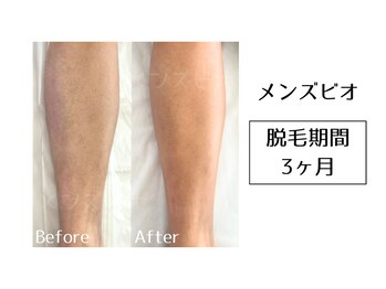 メンズビオ 神戸三宮店/