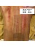 【漢方アロマで巡り改善】首肩・背中のコリすっきり(60分)