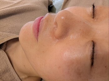 イクヨノ ビューティーサロン(194's beauty salon)の写真/【1回で変化を実感、3回で動き出す】敏感肌にこそ試してほしい"育てるハーブピーリング"で本気の肌質改善。