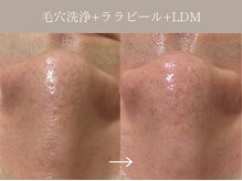 リィ プラス(Riii plus)/【韓国肌管理】