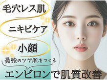 エスティエ(Estie)