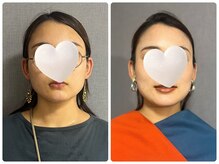 キラリナ/30代☆トータル診断