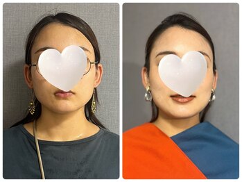 キラリナ/30代☆トータル診断