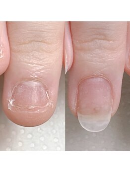 スマイルニコ(smile nico)/