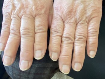 結愛(ゆうあ)の写真/手首の痛みや痺れを解消したい