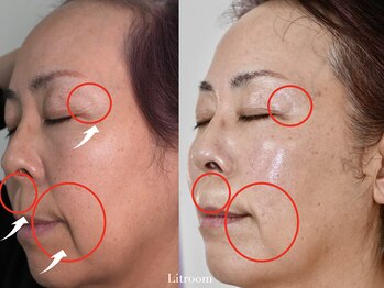 リトルーム(Litroom: from Seoul)/50代でも、肌は変われる