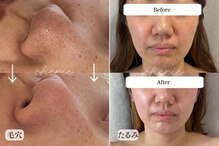 シェリー(cherie)