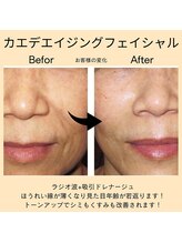 ベルミ―ランド いなげや大和相模大塚/カエデエイジングフェイシャル２