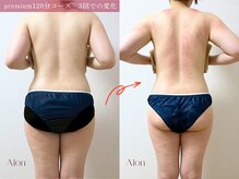 アイオン(Aion)/産後の体型戻しましょう