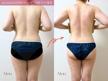 アイオン(Aion)/産後の体型戻しましょう