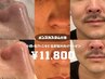 【Brillioメンズ】小顔・ニキビ/あと改善・毛穴汚れナシで沼るモテ肌へ!!!!