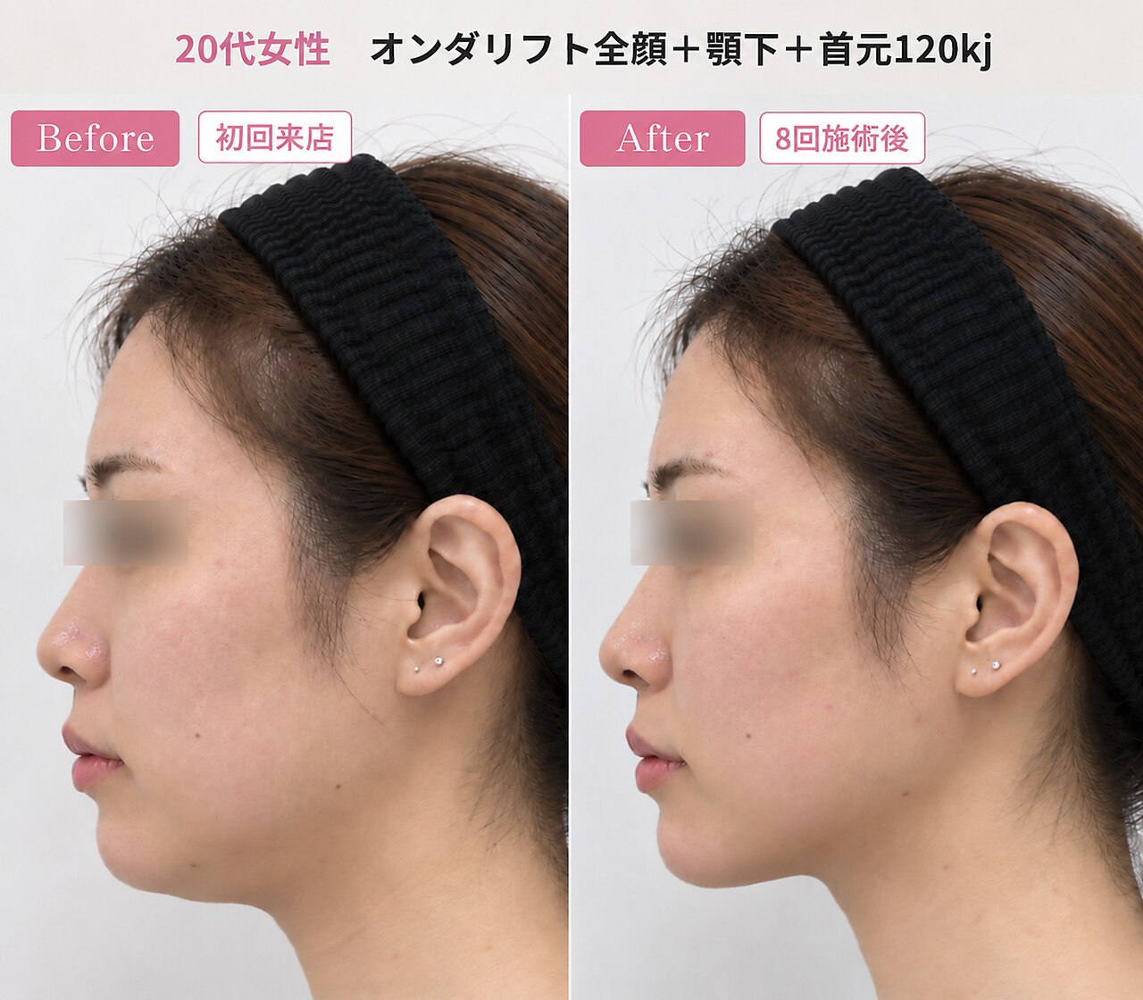 リフト 静岡(Lift)｜ホットペッパービューティー