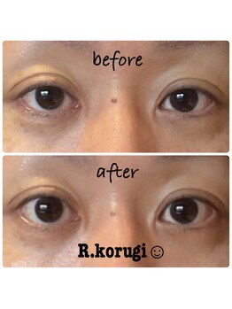 サロン ド アール(salon de R.)/【小顔骨氣・30代・お目元効果】