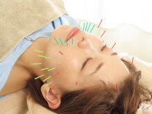 ボディ キュア 鍼灸院(Body Cure 鍼灸院)/美容鍼