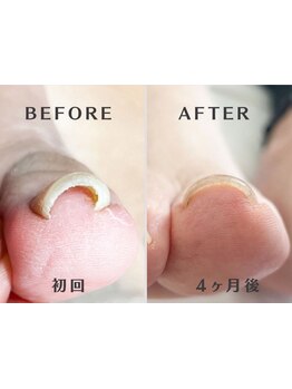 爪の悩みを解消できる（ケア含む）