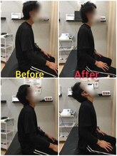 くすの樹接骨院/整体院 鳥栖院/整体/骨盤矯正ビフォーアフター