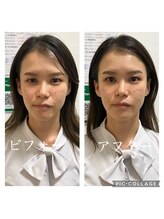 呼吸の音/目の疲れがスッキリ、パッチリ！