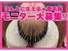 【ほんとに増える！モニター募集★ルート鍼×育毛促進】★頭もスッキリ！