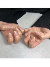 エムズネイル(M’s NAIL)/スキニーフレンチ☆