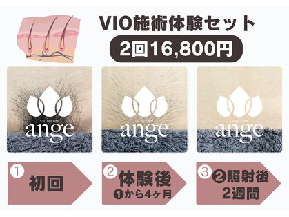 アンジュ(ange)の写真