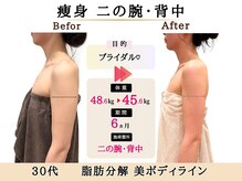 グレースエール トータルビューティーサロン(Grace Aile)/痩身ダイエット