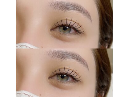 ユン(yun)の写真