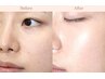 【水光生美容液ピーリング】★エステ版ポテンツァ★ハリ艶NO.1♪韓国艶美肌