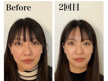 ピオニー(Peony)/Before & After