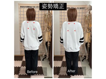 コアスタイル(Core×Style)/【姿勢矯正】Before → After