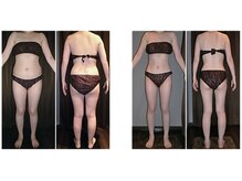 ミネルバエンダモロジー/エンダモロジー/痩身/ウェルネス