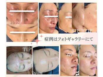 ムーンリズム(Moonlism)