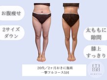 ベベティー(BEBETIE)/＼服のサイズXL→Mサイズへ☆／