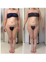 セルビューティー(Cell Beauty)/アラフィフ、食事制限なし！