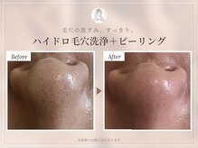 レイラニ(Leilani)
