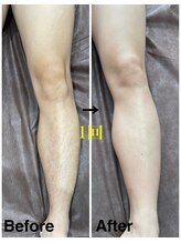 ボス 岡崎店(BOSS)/【メンズ脱毛/足脱毛】