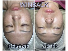 シストワ(sistoi)/メニューに迷ったら★WINBACK♪