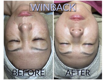 シストワ(sistoi)/メニューに迷ったら★WINBACK♪