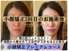 シンメトリー 札幌(SYMMETRY)の雰囲気（プロの施術であっと驚く変化！小顔矯正で新しい自分と出会える◎）