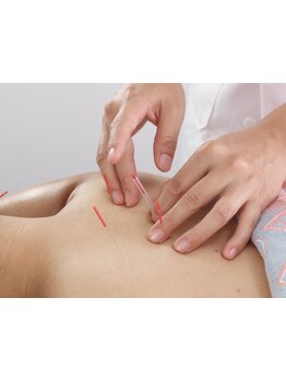 疲れを解消したい